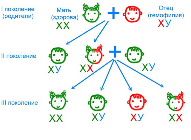 Гемофилия