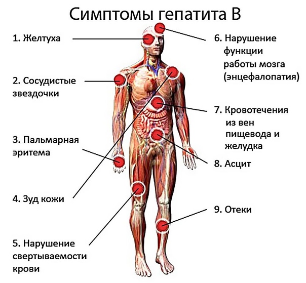 Гепатит В: причины, симптомы, диагностика и лечение