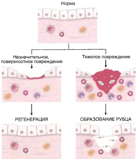 Механизмы заживления ткани: регенерация и формирование рубца