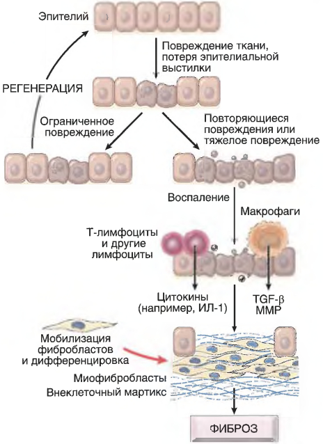 Механизмы фиброза