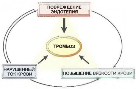 Триада Вирхова при тромбозе